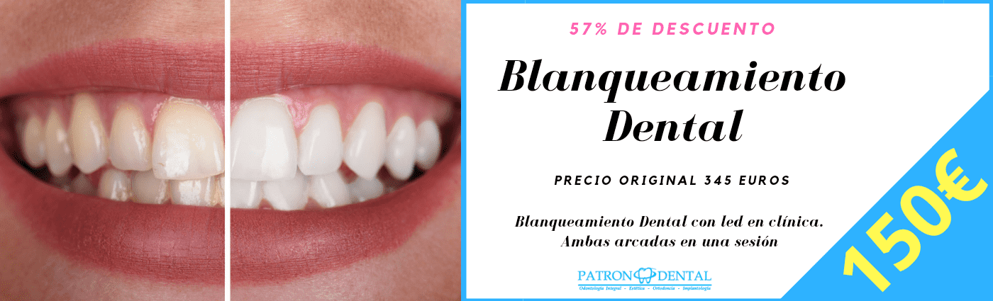 cupon blanqueamiento dental