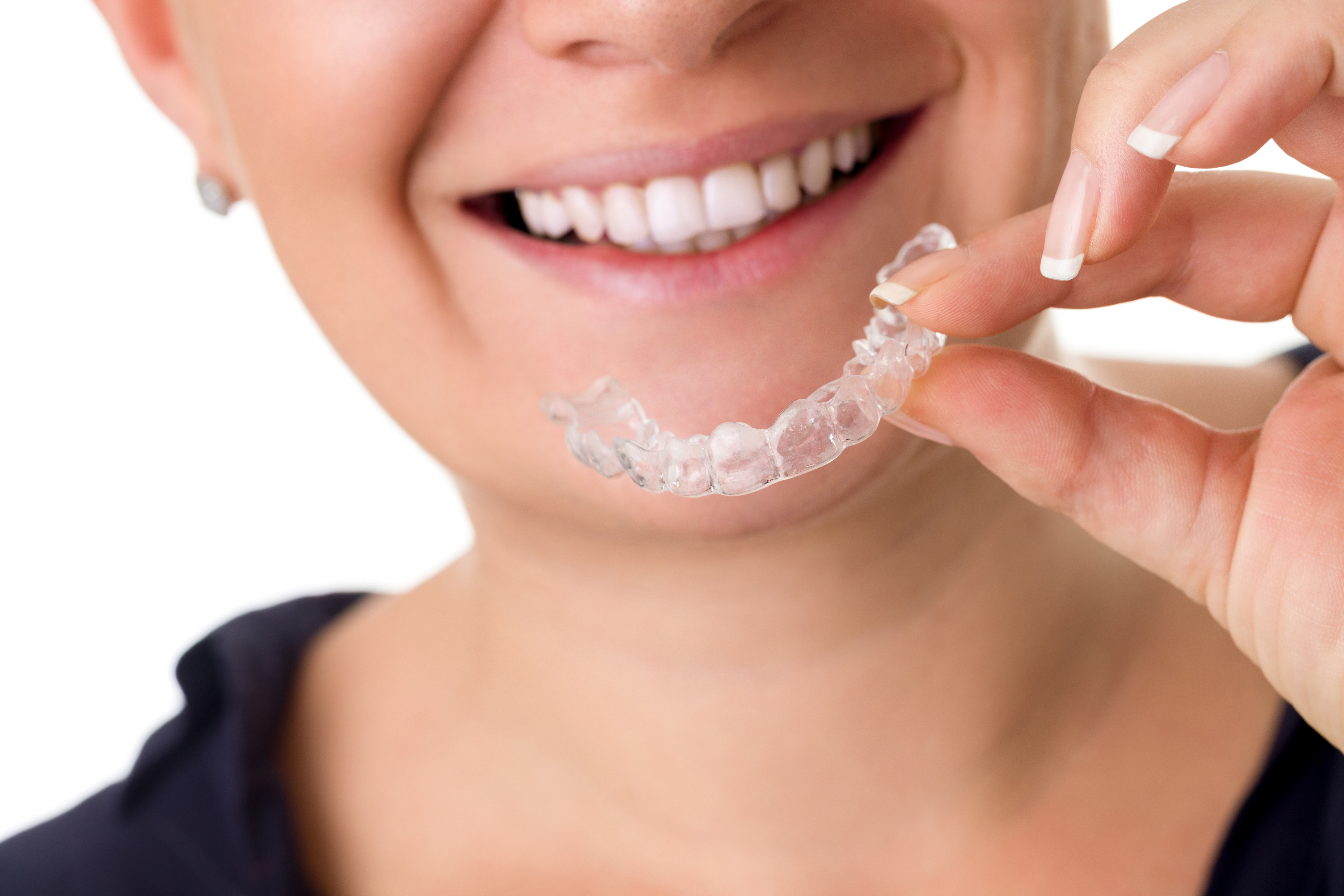 Aligners