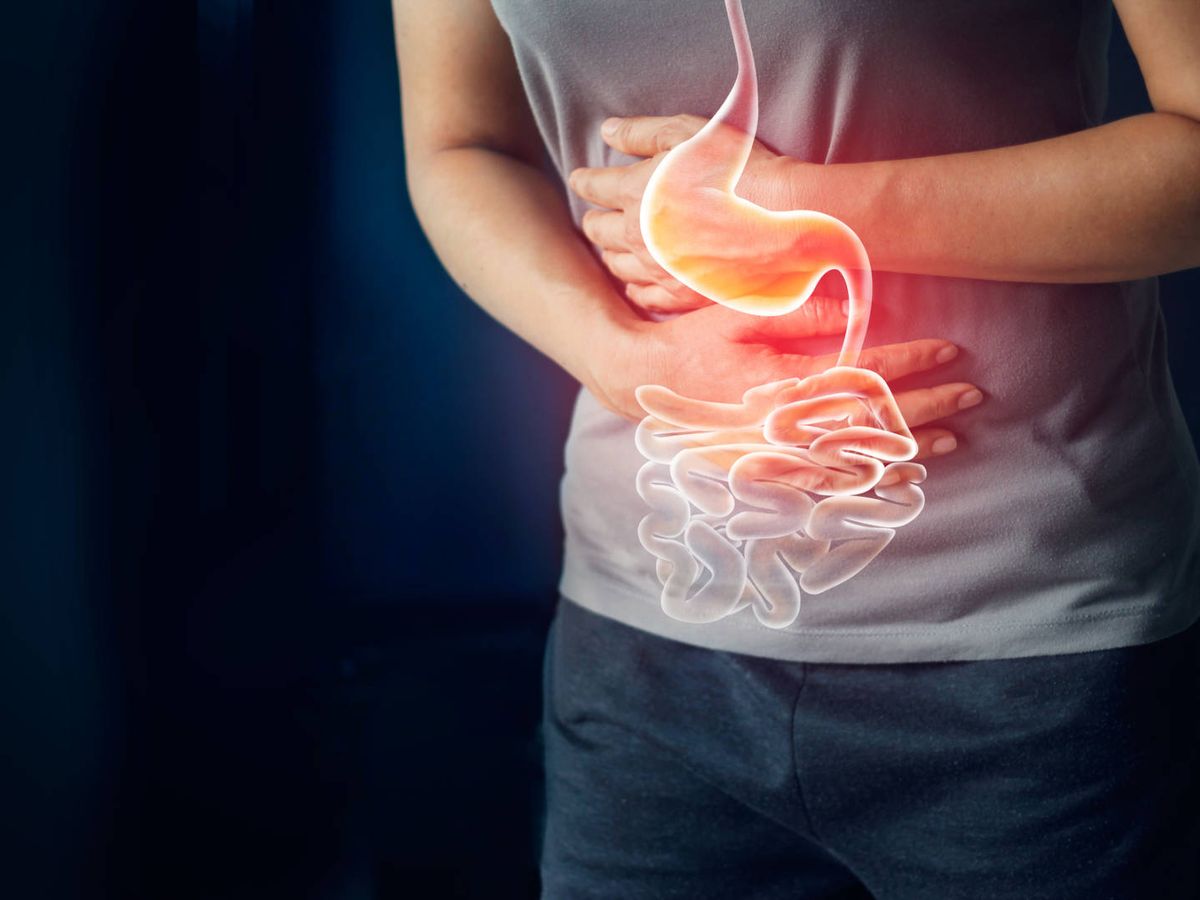 EL COLON IRRITABLE Y LA HIPNOSIS